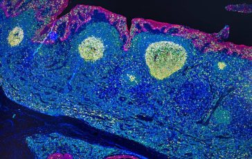 Irccs Pascale Napoli mappa Gps delle cellule rivoluziona limmunoterapia 364x230