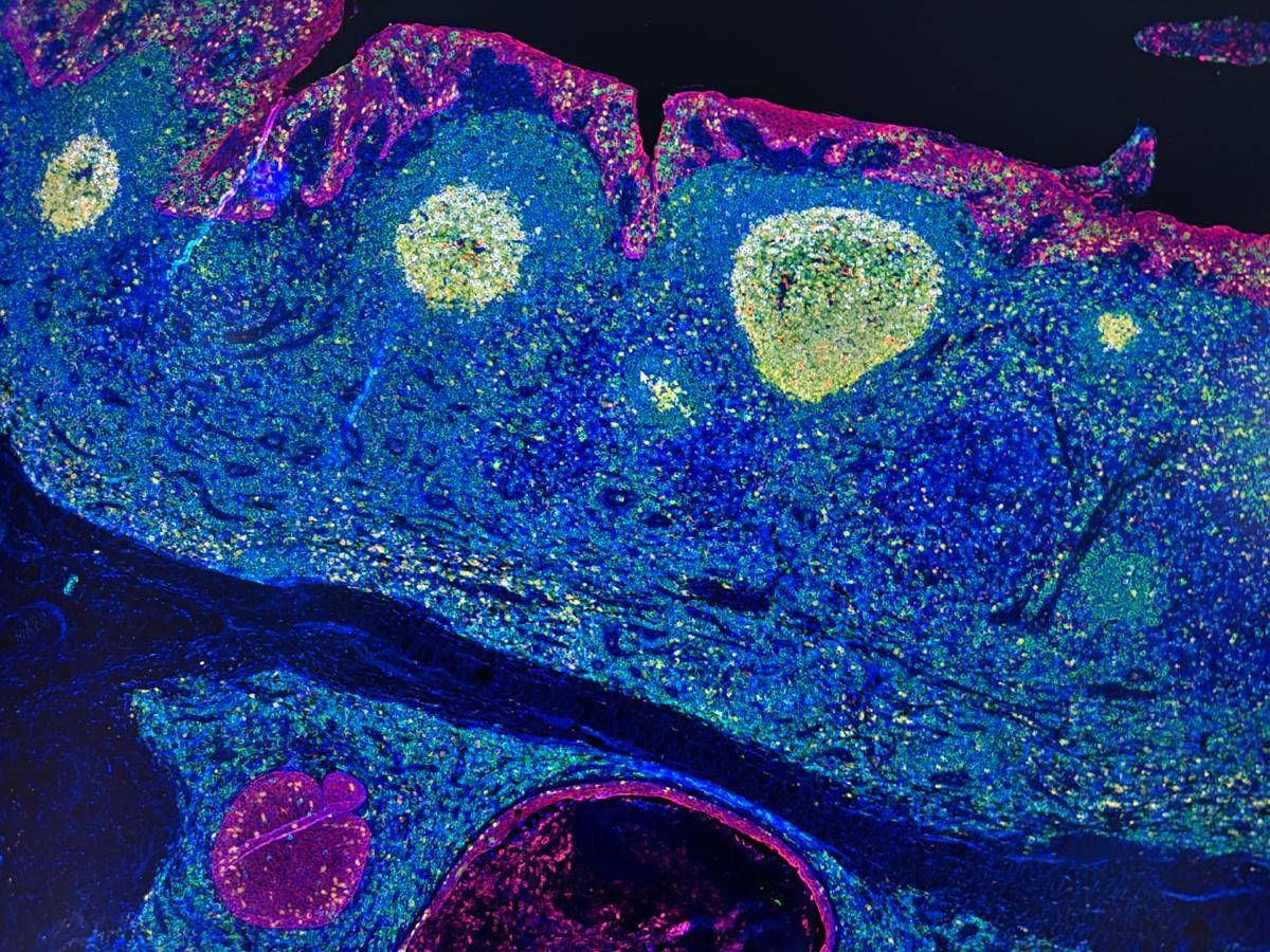 Irccs Pascale Napoli, 'mappa Gps' delle cellule rivoluziona l'immunoterapia