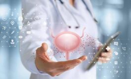 Tumori alla vescica esperti Nel 2025 oltre 29mila diagnosi 50 casi dovuti a fumo 265x160