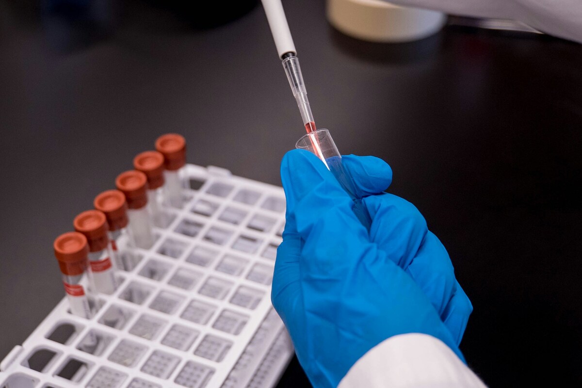 "Sfugge ai vaccini", arriva la nuova variante Covid Cicada: i sintomi