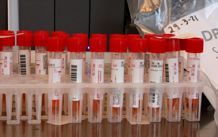 Epatite A Campania Lazio