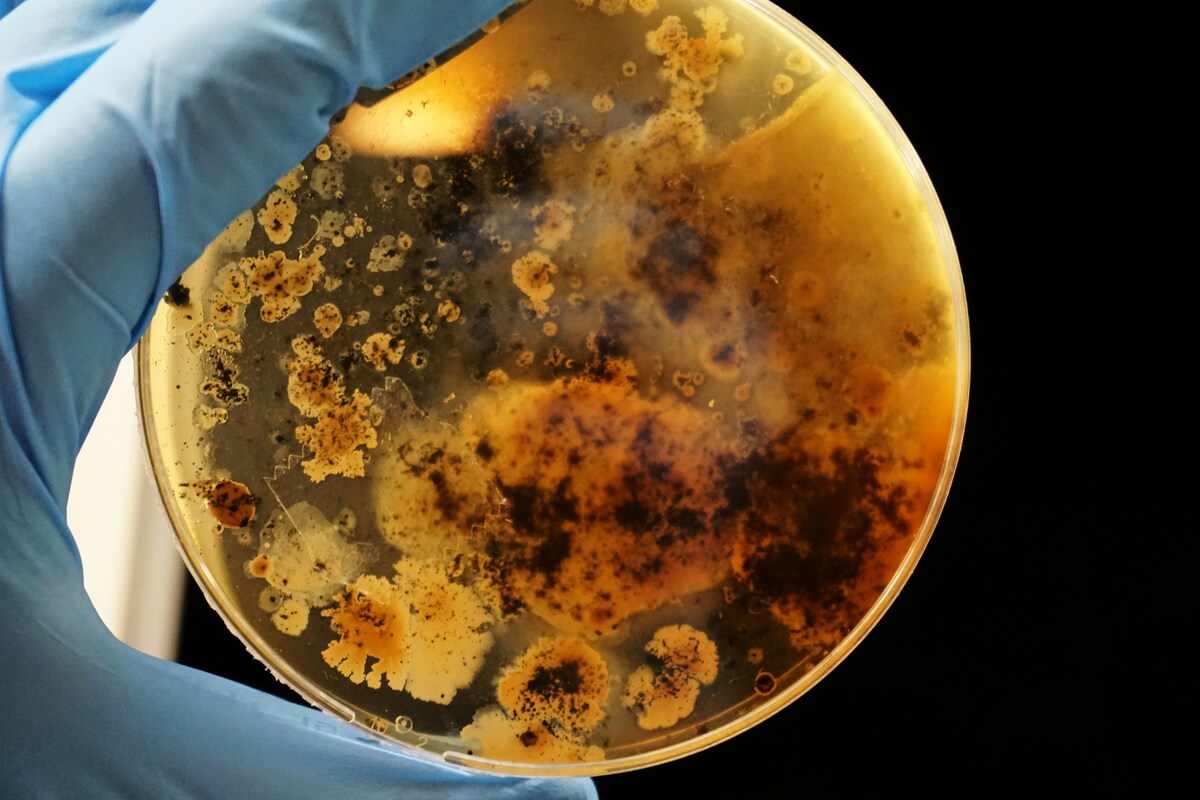 Conan, il batterio indistruttibile che arriva da Marte: è arrivato sulla Terra grazie a un meteorite?
