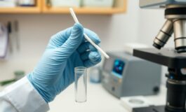 tampone nasale per la diagnosi precoce dellalzheimer come funziona 1773898768 265x160