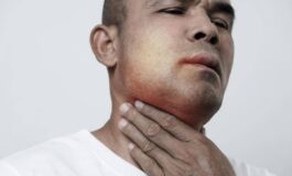 Angioedema ereditario Aifa estende uso lanadelumab dai 2 anni di eta 265x160
