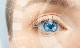 Cataratta arriva il super laser con IA che guida il chirurgo debutto italiano allIrcss Negrar 265x160