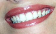 Dentista senza prenotazione a Roma allIsola Tiberina visite immediate per urgenze e controlli 185x115