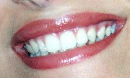 Dentista senza prenotazione a Roma allIsola Tiberina visite immediate per urgenze e controlli 265x160