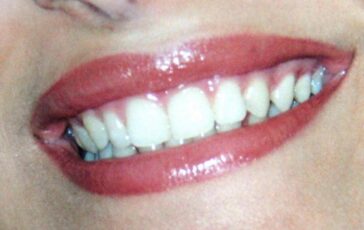 Dentista senza prenotazione a Roma allIsola Tiberina visite immediate per urgenze e controlli 364x230