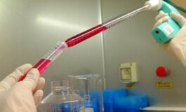 Melanoma uveale metastatico Tebentafusp raddoppia sopravvivenza a 5 anni 265x160