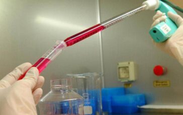 Melanoma uveale metastatico Tebentafusp raddoppia sopravvivenza a 5 anni 364x230