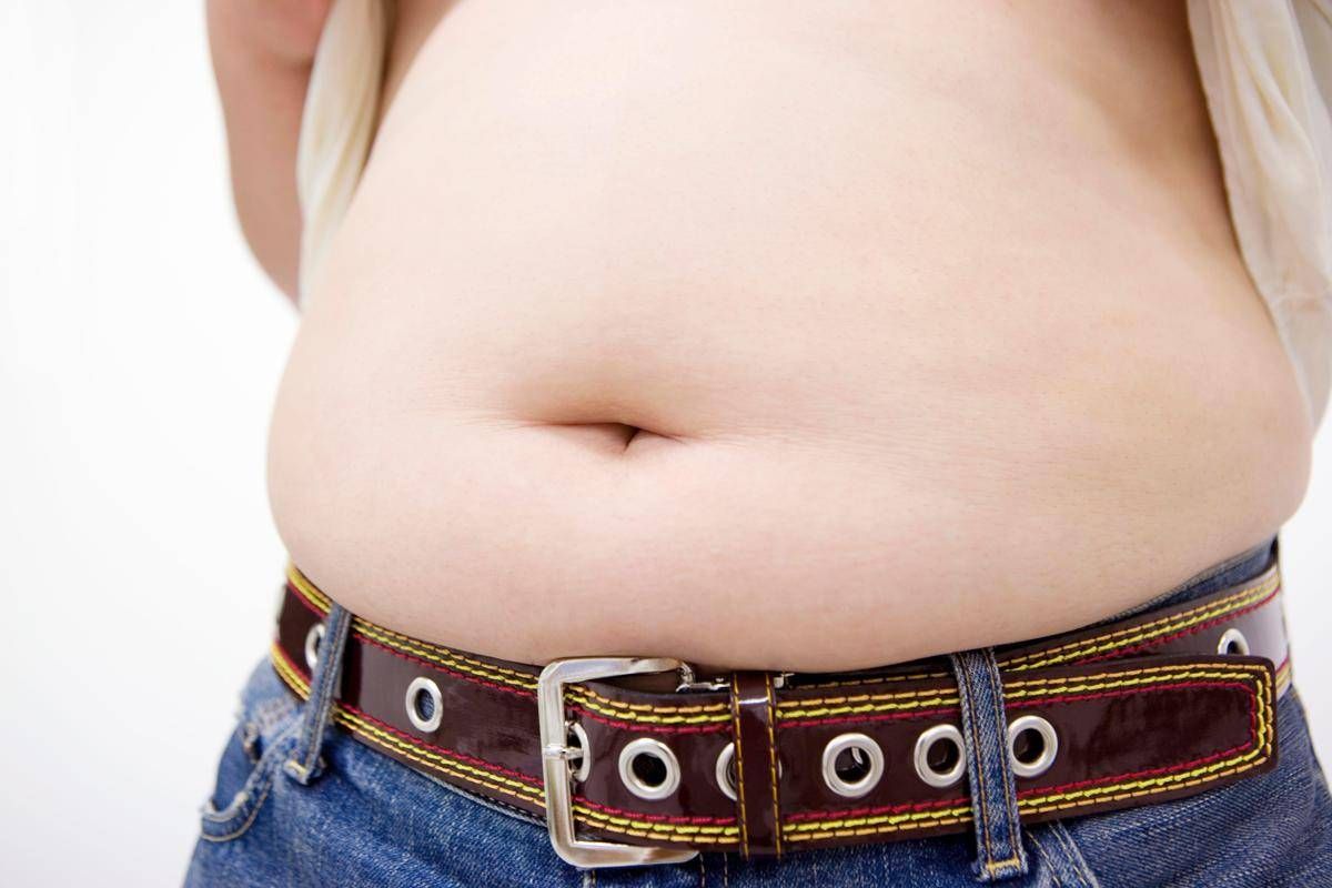 Obesità, allarme ictus anche nei giovani: peso in eccesso moltiplica il rischio