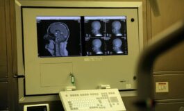 Sogni agitati sintomo Parkinson Medici anti bufale puo accadere si fa polisonnografia 265x160