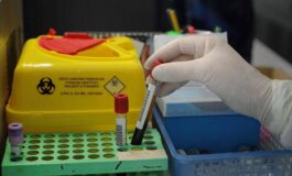 Tumori nuovo test del sangue low cost promette di scoprire diversi tipi di cancro 265x160