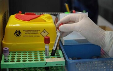 Tumori nuovo test del sangue low cost promette di scoprire diversi tipi di cancro 364x230