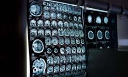 Uno spray nasale ferma linvecchiamento del cervello lo studio 265x160