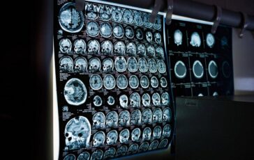 Uno spray nasale ferma linvecchiamento del cervello lo studio 364x230