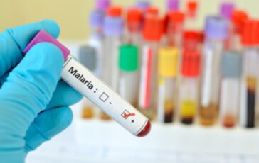 001-ultimi-dati-si-sta-creando-stallo-per-risolvere-problema