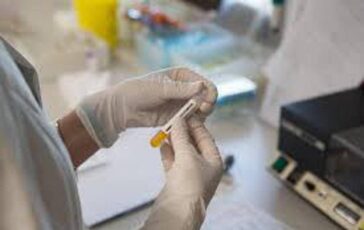 Cancro prostata metastatico ormonosensibile nuovi dati su darolutamide mostrano benefici in sopravvivenza 364x230