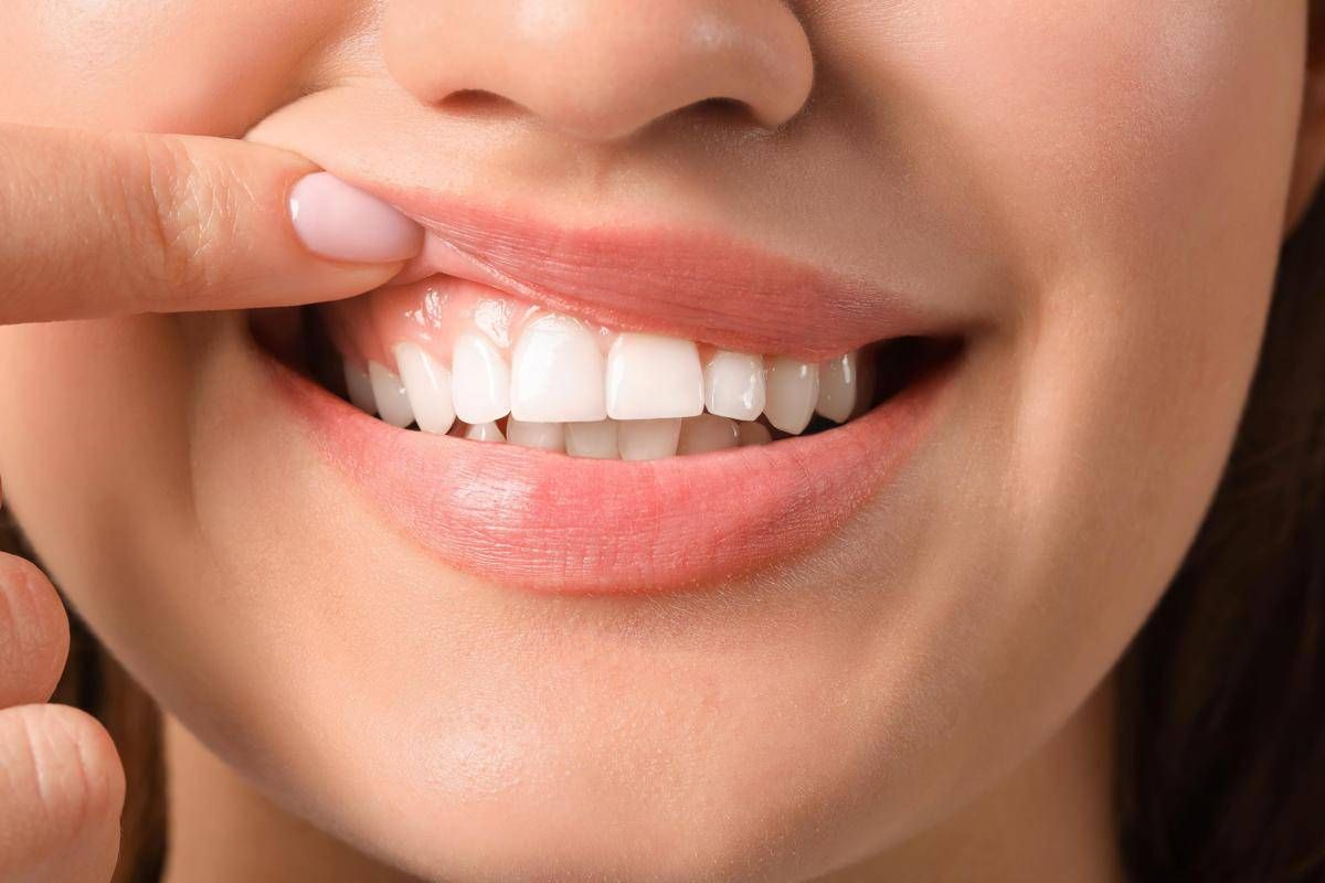 Denti a rischio tra i giovani, Sidp: "Il 36% della Gen Z ha gengive che sanguinano"