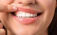 generazione z sorrisi social ma gengive malate 1 su 3 ha problemi orali 2