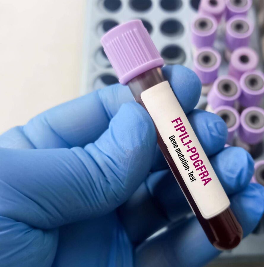 Giornata patologie eosinofile, allergologo Caminati: "Diagnosi complessa"