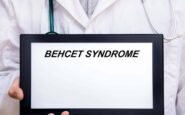 giornata sindrome behcet esperto oggi possiamo prevenire cecita 2