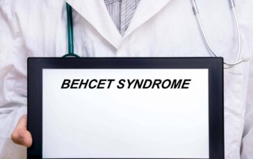 giornata sindrome behcet esperto oggi possiamo prevenire cecita 2