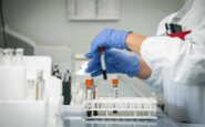 hantavirus 4 persone monitorate in italia non hanno sintomi 2