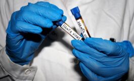 Hantavirus Ema monitora diffusione Pronti a supportare iter vaccini 265x160