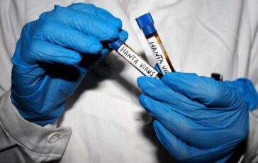 Hantavirus Ema monitora diffusione Pronti a supportare iter vaccini 364x230
