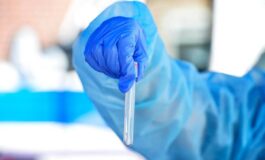 Hantavirus il punto contagio e sintomi cosa ce da sapere e come proteggersi 265x160