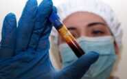 hantavirus negativo il turista inglese in quarantena a milano test per una donna ricoverata a messina 2