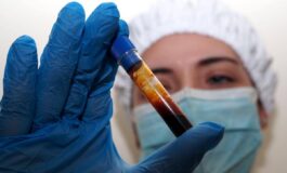 Hantavirus negativo il turista inglese in quarantena a Milano. Test per una donna ricoverata a Messina 265x160