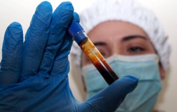 hantavirus negativo il turista inglese in quarantena a milano test per una donna ricoverata a messina 2