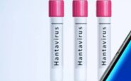 hantavirus non puo causare pandemia ma epidemie gravi si lo studio su focolaio mv hondius 2