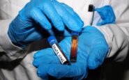 hantavirus test negativo per la persona in isolamento in veneto 2