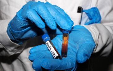 Hantavirus test negativo per la persona in isolamento in Veneto 364x230