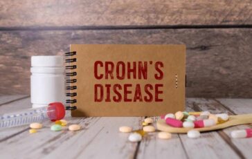 Malattia Crohn con fistole nuovi dati su terapia monoclonale 364x230