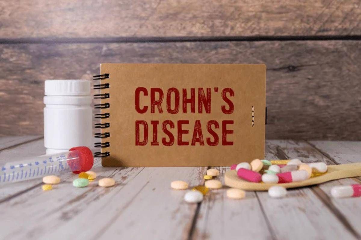 Malattia Crohn con fistole, nuovi dati su terapia monoclonale