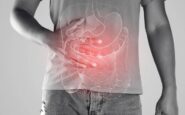 malattie infiammatorie croniche lindagine 4 pazienti su 5 non ricevono consulenze nutrizionali 2