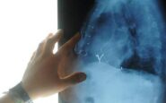 radiologia interventistica ssn e fondazioni per cure piu accessibili 2