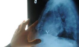 Radiologia interventistica Ssn e fondazioni per cure piu accessibili 265x160