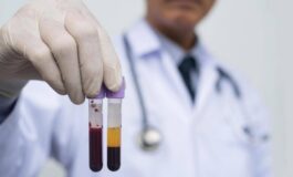 Ricerca allo studio analisi sangue a casa e test cerebrali online per scoprire rischio demenza 265x160