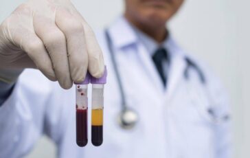 Ricerca allo studio analisi sangue a casa e test cerebrali online per scoprire rischio demenza 364x230