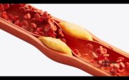 salute nuove linee guida dislipidemie abbassare e stabilizzare colesterolo 2