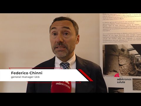 Sanità, Chinni (Ucb): "Innovazione ha cambiato storia delle malattie"