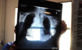 Sirm Ai strumento anti liste dattesa 50 esami imaging per over70 non necessario 265x160