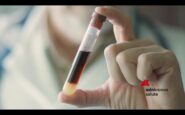 tumori seno metastatico a milano oncologi e pazienti chiedono accesso equo alla biopsia liquida 2