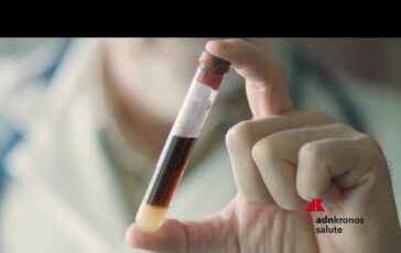 Tumori seno metastatico a Milano oncologi e pazienti chiedono accesso equo alla biopsia liquida 364x230