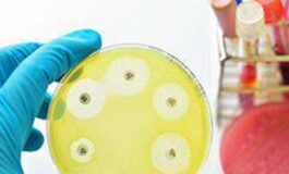 Ai e medicina di precisione per combattere super batteri resistenti lo studio italiano su quasi 10.000 pazienti 265x160